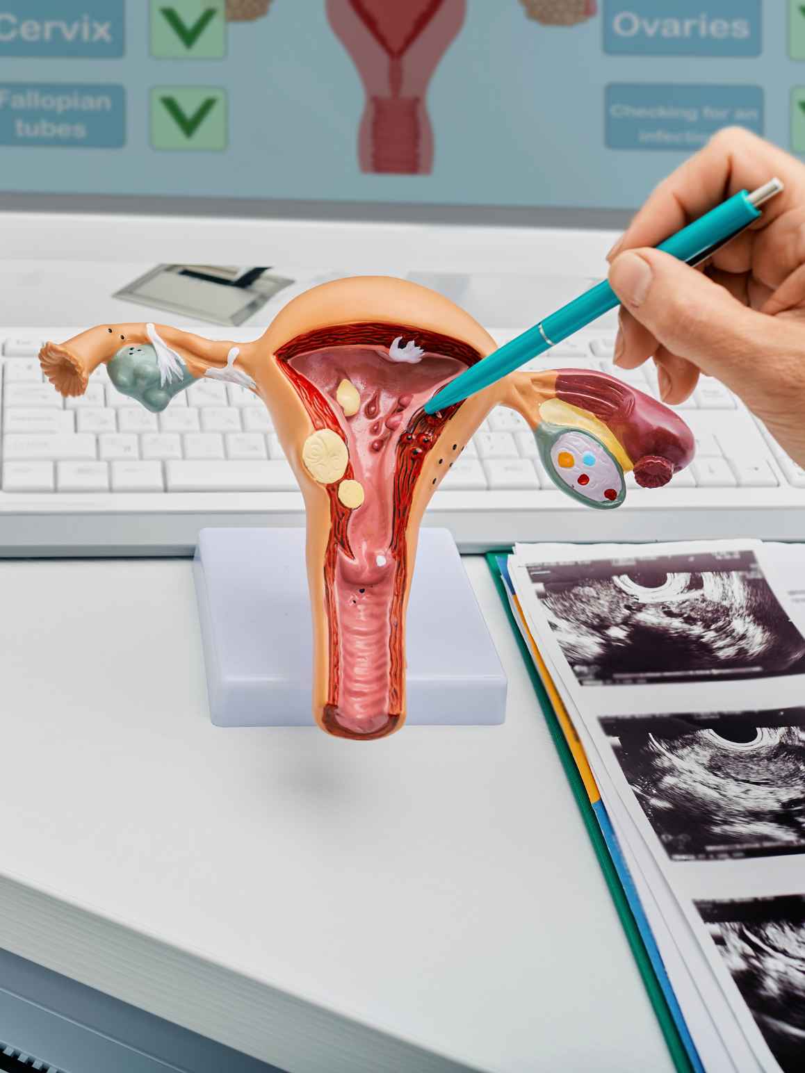 An anatomical model of a female reproductive system on a white stand, with a hand holding a teal pointer pen pointing to the uterus. A computer keyboard, a medical reference chart, and ultrasound images are visible in the background.